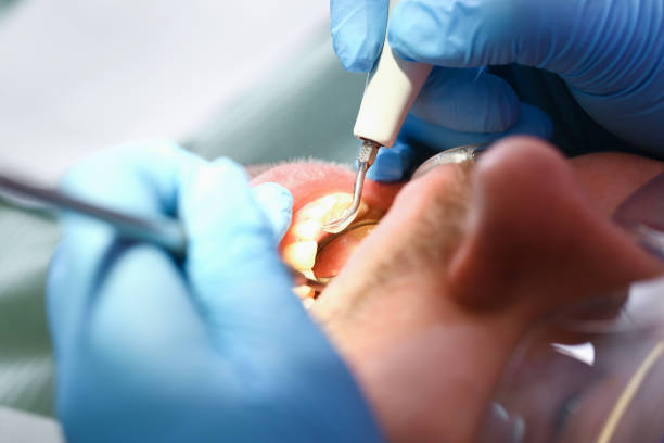 Best Emergency Broken Tooth Repair in Bristol, IN
