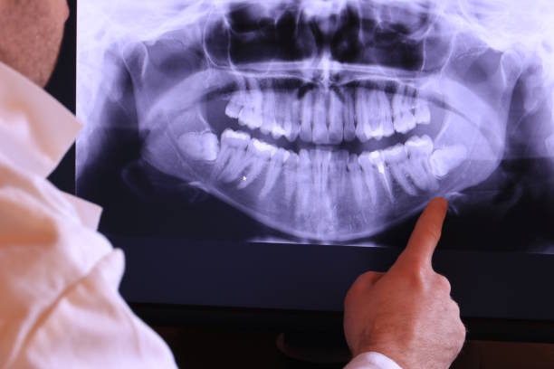Best Emergency Broken Tooth Repair in Bristol, IN
