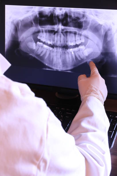Best Emergency Root Canal Treatment in Bristol, IN